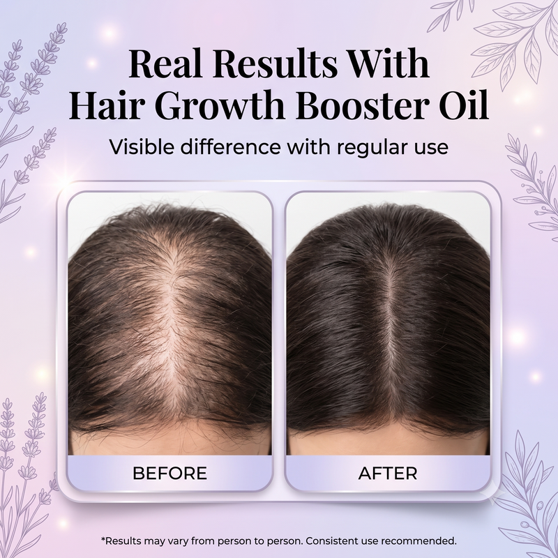 Hair Growth Booster Herbal Oil